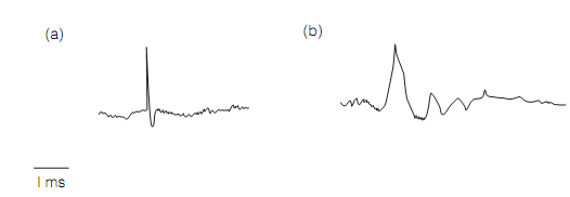 765_Inputs to the cerebellar cortex 2.png